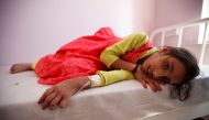 A girl lies on a bed at a hospital where she is receiving treatment for cholera amid confirmation by the UNICEF and the World Health Organization of an outbreak of the epidemic in Sanaa, the capital of Yemen October 11, 2016. REUTERS/Khaled Abdullah