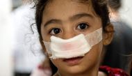 A child injured by a firecracker arrives at the Jose Reyes Memorial Medical Center in Manila early on January 1, 2017, after new year's celebrations. AFP / NOEL CELIS
