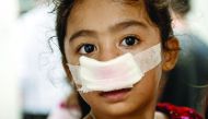 A child injured by a firecracker arrives at the Jose Reyes Memorial Medical Center in Manila early yesterday, after New Year's celebrations. 