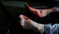 The feet of an injured man are seen covered in blood after a suicide attack in Kabul, Afghanistan January 10, 2017. REUTERS/Mohammad Ismail