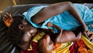 A mother breastfeeding her child who suffers acute malnutrition at the clinic run by MSF in Aweil, northern Bahr al-Ghazal, South Sudan on October 11, 2016 (AFP / Albert Gonzalez Farran) 