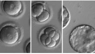 This sequence of images shows the development of embryos after being injected with biological kit to edit their DNA, removing a genetic mutation known to cause hypertrophic cardiomyopathy. (Oregon Health & Science University)