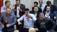 Macedonia's current Prime Minister Zoran Zaev was hurt during the April 27 unrest. AA
