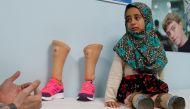 Maya Meri, 8, waits at a prosthetic center in Istanbul, Turkey, July 5, 2018. Picture taken July 5, 2018. REUTERS/Osman Orsal 