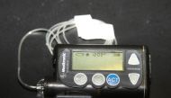 A Medtronic Corp insulin pump in this file photo taken on October 10, 2014 in Meridian, Idaho Reuters/Brian Losness 
