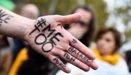 Me too on the hand of a protester during a Paris gathering on October 29, 2017. AFP/Bertrand Guay