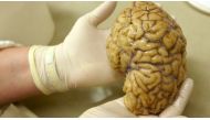 Authors of the US-based study said their research could one day be used to help treat victims of heart attacks and strokes and unravel the mysteries of brain trauma. Reuters file photo/Denis Balibouse
