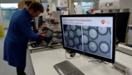 A scientist studies cancer cells inside white blood cells through a microscope at the GlaxoSmithKline (GSK) research centre in Stevenage, Britain November 26, 2019. Reuters/Peter Nicholls