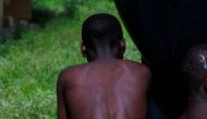 A child rescued by police from captivity, with strike marks on his back, bathes at the Hajj transit camp in Kaduna, Nigeria September 28, 2019. Reuters/Afolabi Sotunde