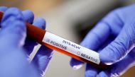 Test tube with Corona virus name label is seen in this illustration taken on January 29, 2020. Reuters/Dado Ruvic
