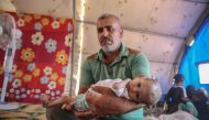7-month-old Syrian baby Wardah carries the risk of losing her life due to an undiagnosed illness is seen on the hands of her father in a tend at Atmeh refugee camp in Idlib, Syria on June 21, 2020.  Muhammed Said - Anadolu 
