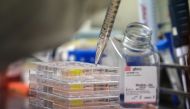 A scientist works on cells that produce antibodies against the coronavirus disease (COVID-19), in a university lab July 8, 2020. Picture taken July 8, 2020. REUTERS/Alkis Konstantinidis