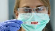 An employee of the diagnostics provider R-Biopharm displays two diagnostic test strips of a rapid antigen test to detect the SARS-CoV-2 antigen at their laboratory in Pfungstadt near Darmstadt, Germany October 8, 2020. REUTERS/Ralph Orlowski
