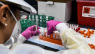 (FILES) In this file photo taken on August 13, 2020, a lab technician sorts blood samples inside a lab for a Covid-19 vaccine study at the Research Centers of America (RCA) in Hollywood, Florida. A key facet of the global mad scramble by Pfizer, moderna a
