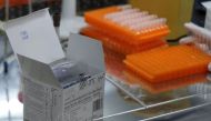 File photo: Tests for detection of Cholera are pictured inside at a disease monitoring centre in rebel-held Idlib, Syria, September 24, 2022. (REUTERS/Khalil Ashawi)
