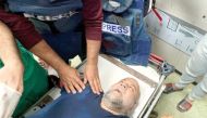 Veteran Al Jazeera correspondent Wael Al Dahdouh receives medical care after he was injured in an Israeli strike while reporting, at Nasser Hospital in Khan Yunis in the southern Gaza Strip, yesterday. (AFP)