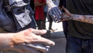 An injured Palestinian child reaches for the hand of a relative that was pulled from the rubble of the Shaheen family home, that was targeted in an Israeli strike in the Saftawi neighbourhood, west of Jabalia, in the northern Gaza Strip on June 9, 2025. (Photo by BASHAR TALEB / AFP)
