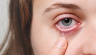 Stock image taken from Freepik website, used for representational purposes. 