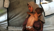 Hidaya, a 31-year-old Palestinian mother, carries her 18-month-old sick son who is also displaying signs of malnutrition, inside their tent at the Al-Shati refugee camp, west of Gaza City, on July 24, 2025. (Photo by Omar Al-Qattaa / AFP)

