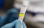 nstitute holding a container used to diagnose the Andes hantavirus, which contains RNA from the Andes virus as part of the detection process, in Buenos Aires on May 6, 2026. Argentina has seen an increase in hantavirus cases but not an outbreak, an expert told AFP on May 6, as infections aboard a cruise ship have provoked a global health scare. The MV Hondius set sail from Ushuaia in southern Argentina on April 1 and is currently anchored off the coast of Cape Verde after three passengers died, possibly of hantavirus. (Photo by Handout / ARGENTINE HEALTH MINISTRY / AFP) 