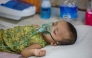 A child diagnosed with measles receives treatment inside a paediatric ward at the Bangladesh Shishu Hospital and Institute in Dhaka on May 6, 2026. (Photo by Salahuddin Ahmed / AFP)