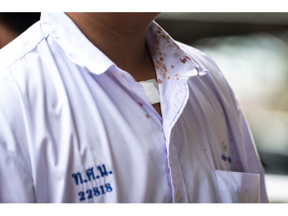 Blood stains are seen on a student's shirt collar following a school shooting in Bang Kruai district, Nonthaburi province, north of Thailand's capital Bangkok, on August 7, 2026. Photo by CHANAKARN LAOSARAKHAM / AFP
