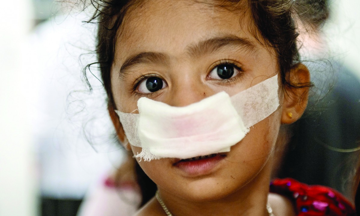 A child injured by a firecracker arrives at the Jose Reyes Memorial Medical Center in Manila early yesterday, after New Year's celebrations. 