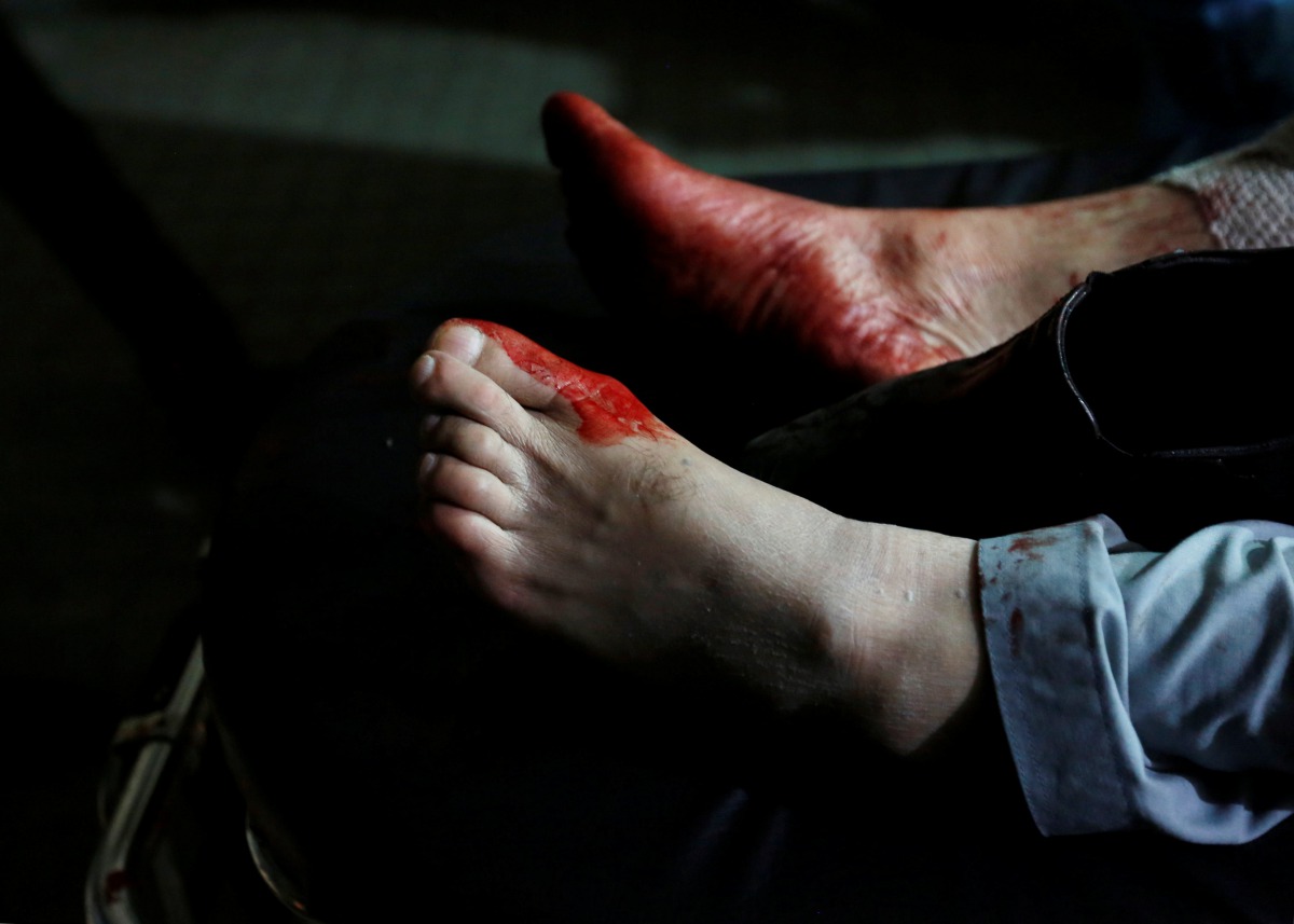 The feet of an injured man are seen covered in blood after a suicide attack in Kabul, Afghanistan January 10, 2017. REUTERS/Mohammad Ismail