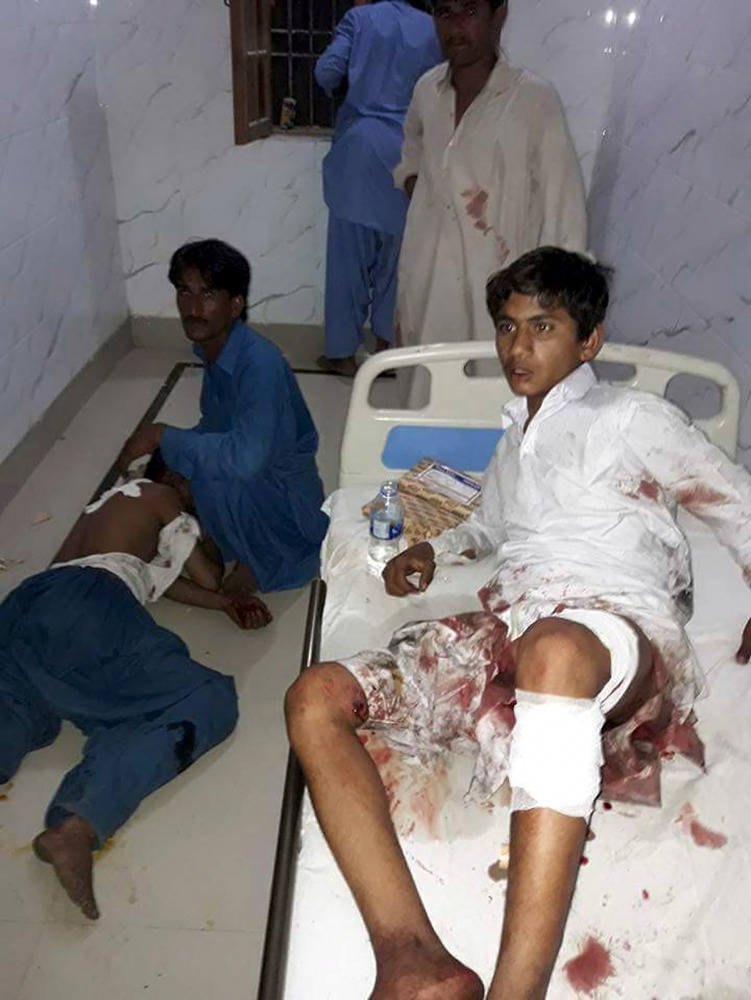 Injured Pakistani blast victims are treated at a local hospital after a bomb explosion in the shrine of 13th century Muslim Sufi saint Lal Shahbaz Qalandar in the town of Sehwan in Sindh province, some 200 kilometres northeast of the provincial capital Ka