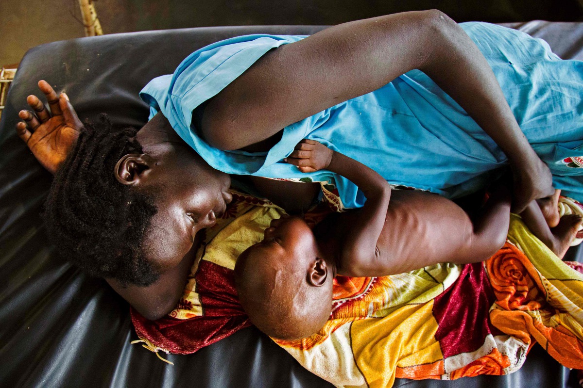 A mother breastfeeding her child who suffers acute malnutrition at the clinic run by MSF in Aweil, northern Bahr al-Ghazal, South Sudan on October 11, 2016 (AFP / Albert Gonzalez Farran) 