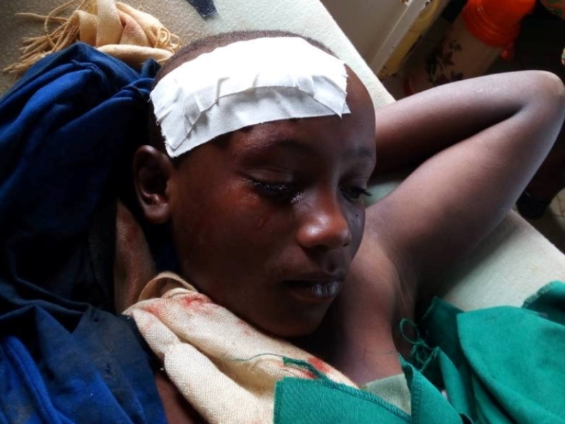 An injured child gets treatment in Kiziba Refugee Camp, Rwanda, April 30, 2018, in this picture obtained from social media. REUTERS