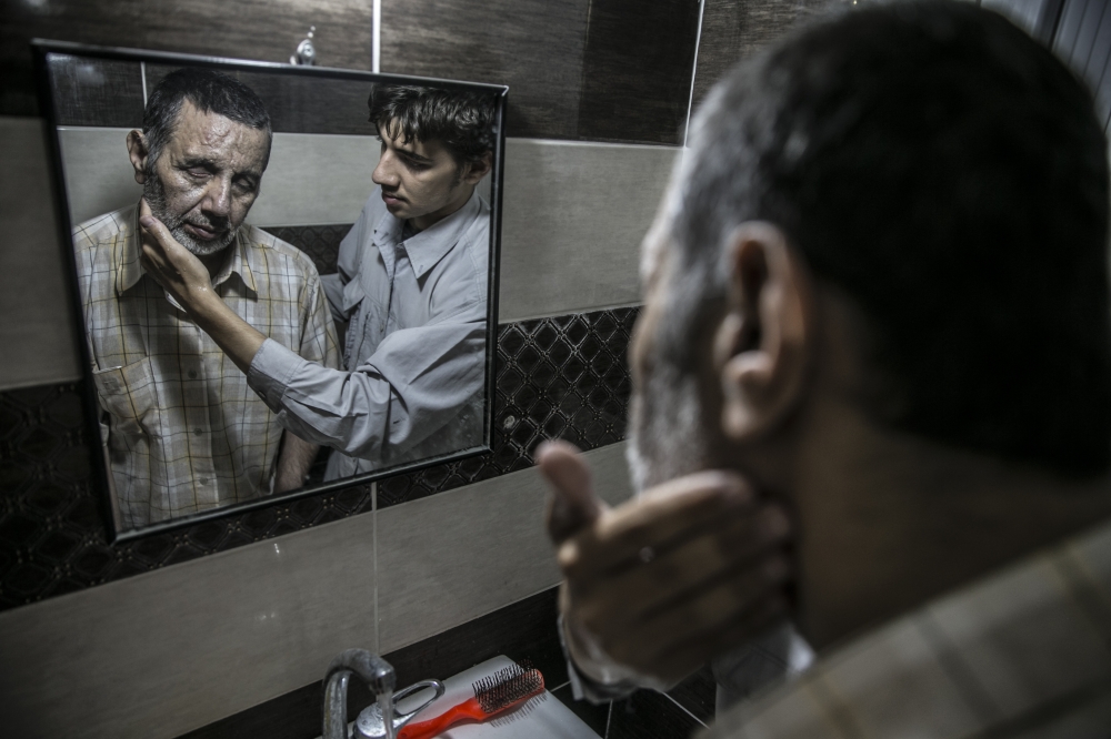 Syrian Muhammed Bessam El Meydani, who lost his eyes by shrapnel pieces during Assad Regime's airstrikes before he left Eastern Ghouta to reach Idlib's rurals, is being shaved in Hatay, Turkey on June 21, 2018. Cem Genco - Anadolu 
