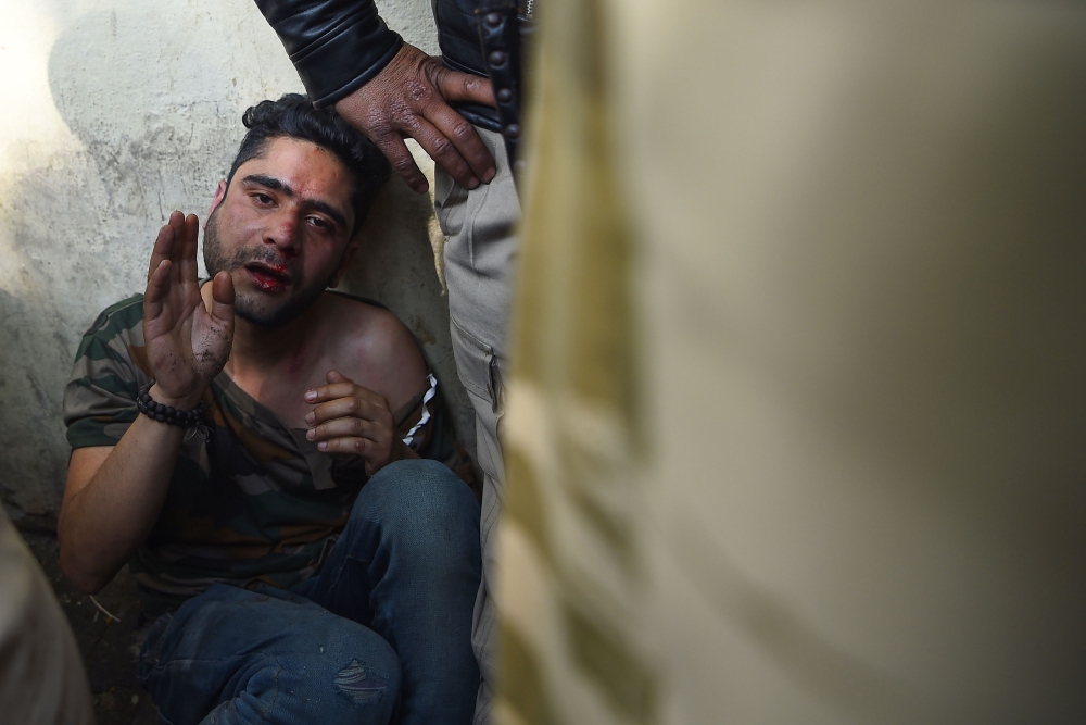 An injured man that an angry mob had attacked, believing him to be a Kashmiri who had shouted pro-Pakistan slogans, is shielded by Indian policemen in New Delhi on February 17, 2019.  AFP / Sajjad Hussain 