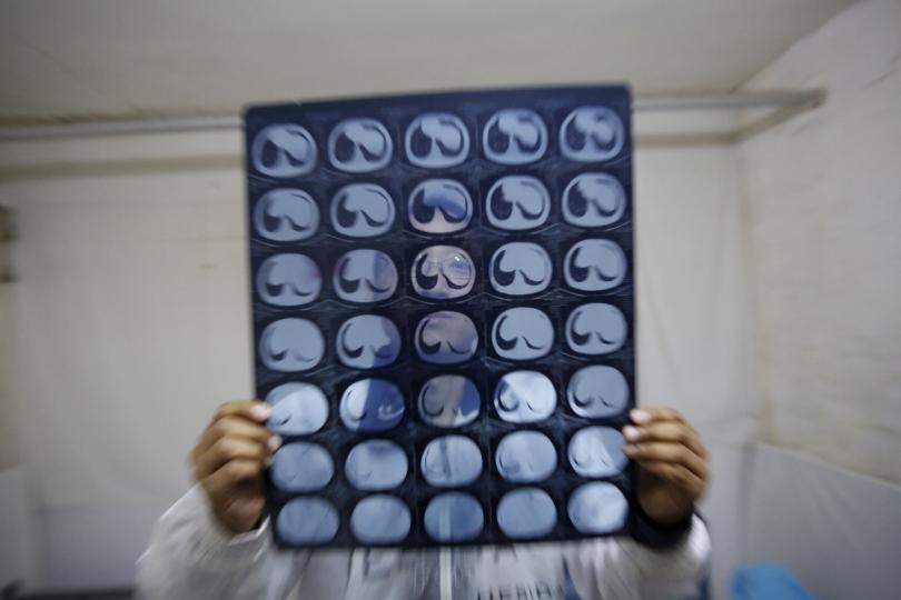A cancer patient poses with CT scan images of his intestine at a hotel room where he stays near the Peking Union hospital in Beijing, April 6, 2016. Reuters/Kim Kyung-Hoon