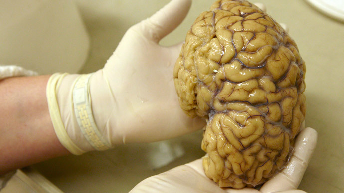 Authors of the US-based study said their research could one day be used to help treat victims of heart attacks and strokes and unravel the mysteries of brain trauma. Reuters file photo/Denis Balibouse
