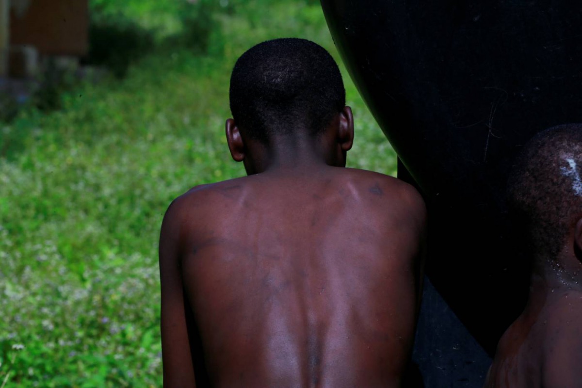 A child rescued by police from captivity, with strike marks on his back, bathes at the Hajj transit camp in Kaduna, Nigeria September 28, 2019. Reuters/Afolabi Sotunde