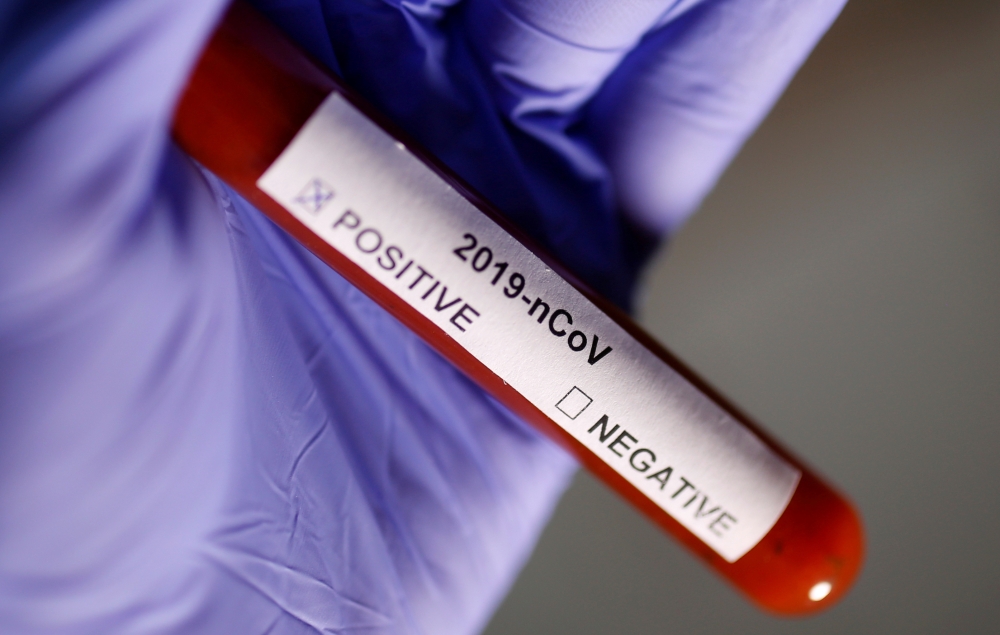:FILE PHOTO: Test tube with Corona virus name label is seen in this illustration taken on January 29, 2020. REUTERS/Dado Ruvic/File Photo
