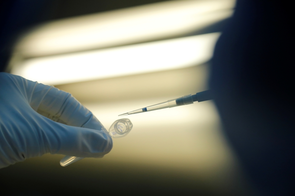 A scientist prepares samples during the research and development of a vaccine against the coronavirus disease (COVID-19) at a laboratory of BIOCAD biotechnology company in Saint Petersburg, Russia June 11, 2020. Reuters/Anton Vaganov