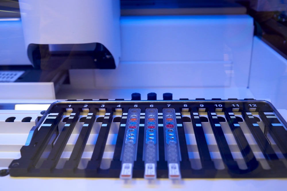 A lab at Methodist Charlton Medical Center tests samples for the coronavirus disease (COVID-19) in a BD Max system in Dallas, Texas, U.S. June 24, 2020. REUTERS/Cooper Neill
