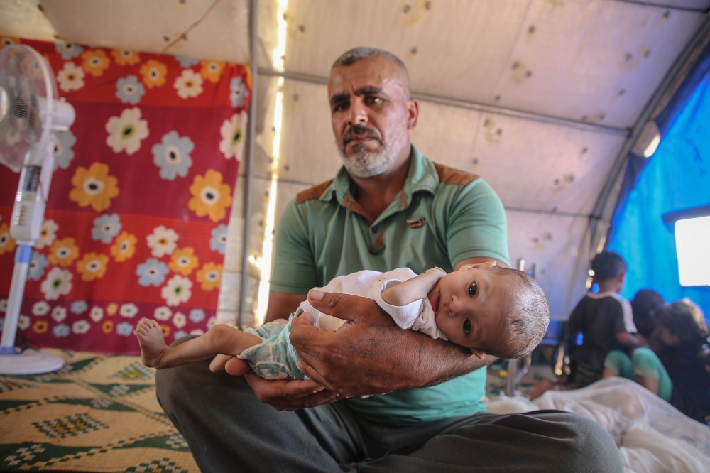 7-month-old Syrian baby Wardah carries the risk of losing her life due to an undiagnosed illness is seen on the hands of her father in a tend at Atmeh refugee camp in Idlib, Syria on June 21, 2020.  Muhammed Said - Anadolu 

