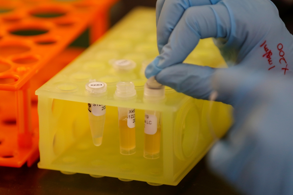 FILE PHOTO: A Lab technician works at Sorrento Therapeutics where efforts are underway to develop an antibody, STI-1499, to help in prevention of the coronavirus disease (COVID-19) in San Diego, California, U.S., May 22, 2020. REUTERS/Mike Blake/File Phot