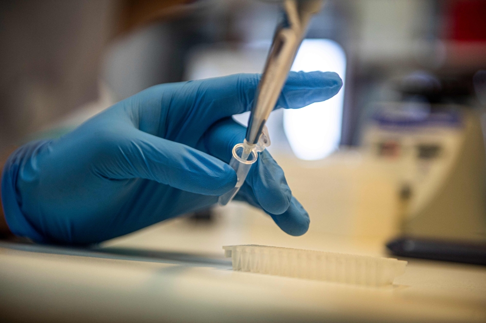 A scientist works at the Neurobiology laboratory of the Cayetano Heredia University in Lima.  AFP / ERNESTO BENAVIDES

