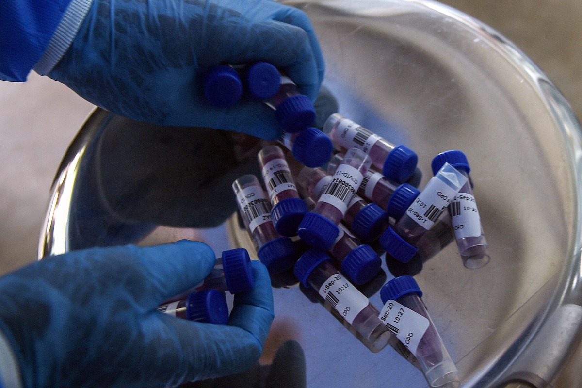 In this picture taken on September 1, 2020, a health official collects swab samples taking from people to test for the COVID-19 coronavirus at a testing site in Karachi./ AFP / Rizwan TABASSUM / To go with AFP story Pakistan-virus-health, FOCUS by Kaneez 
