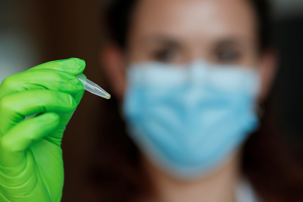 A biologist shows a EasyCOV rapid salivary test which displays yellow reagent positive at the Covid-19 disease, in Paris, France, October 12, 2020. Picture taken October 12, 2020. REUTERS/Benoit Tessier