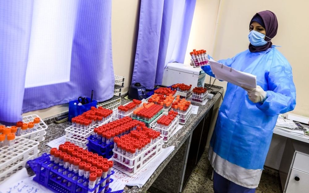 A technician handles collected PCR (polymerase chain reaction) swab samples collected as part of COVID-19 coronavirus disease testing, at the Palestinian Gaza-based Health Ministry central laboratory in Gaza City on December 7, 2020. / AFP / MAHMUD HAMS