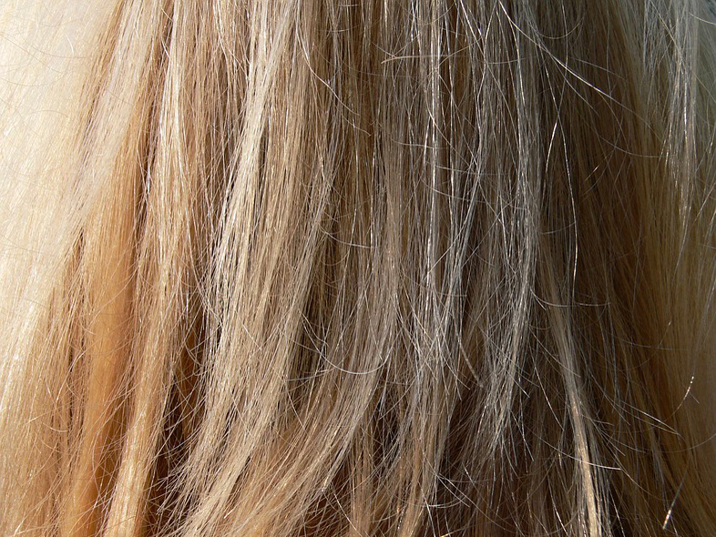 Representational picture 