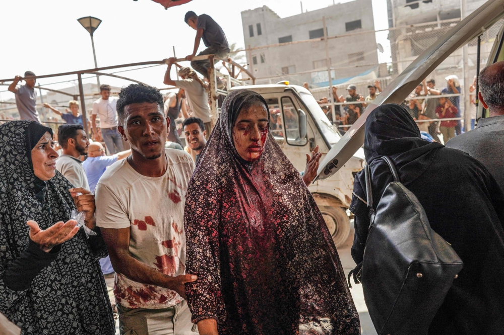 Palestinians rush casualties to Nasser hospital in Khan Yunis following Israeli bombardment east of the city in the southern Gaza Strip on July 22, 2024. (Photo by Bashar Taleb / AFP)