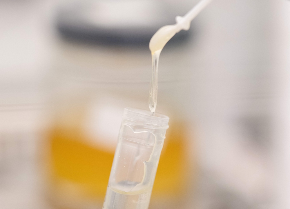 Scientist Anna Mutti, MSc. NGS Specialist for DNA analysis in the field of metabarcoding, is testing a sample of honey at Sinsoma laboratory in Voels, Austria on March 19, 2025. (Photo by Joe Klamar / AFP)