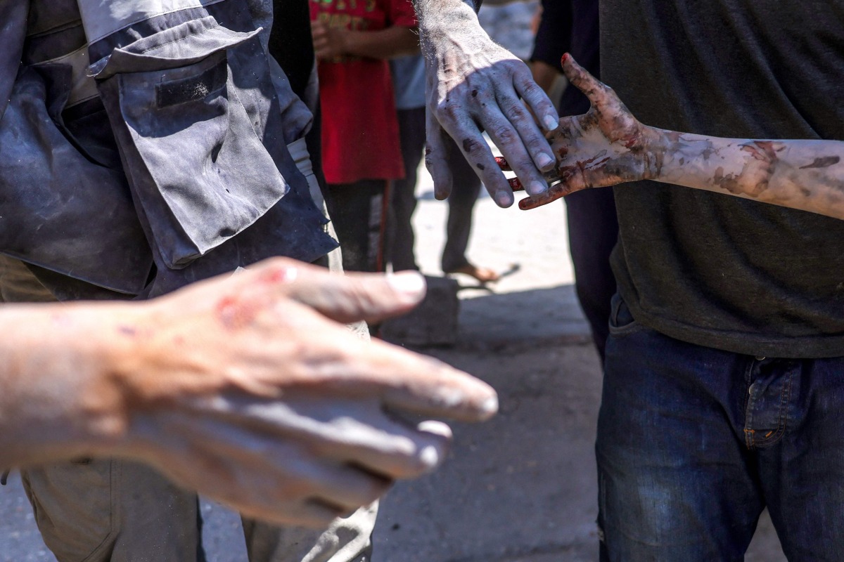An injured Palestinian child reaches for the hand of a relative that was pulled from the rubble of the Shaheen family home, that was targeted in an Israeli strike in the Saftawi neighbourhood, west of Jabalia, in the northern Gaza Strip on June 9, 2025. (Photo by BASHAR TALEB / AFP)
