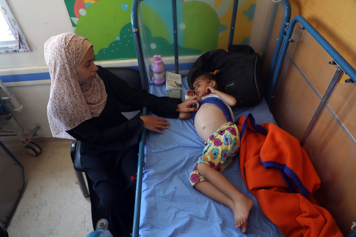 A Palestinian child suffering from malnutrition due to starvation is seen at Al-Rantisi Hospital in northern Gaza City, on July 23, 2025. (Photo by Rizek Abdeljawad/Xinhua)
